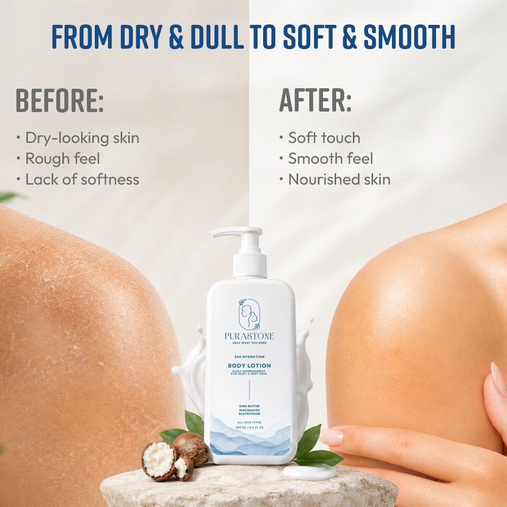 Body Lotion | Shea Butter + Niacinamide | Deep Hydration for Men & Women — 200 ml