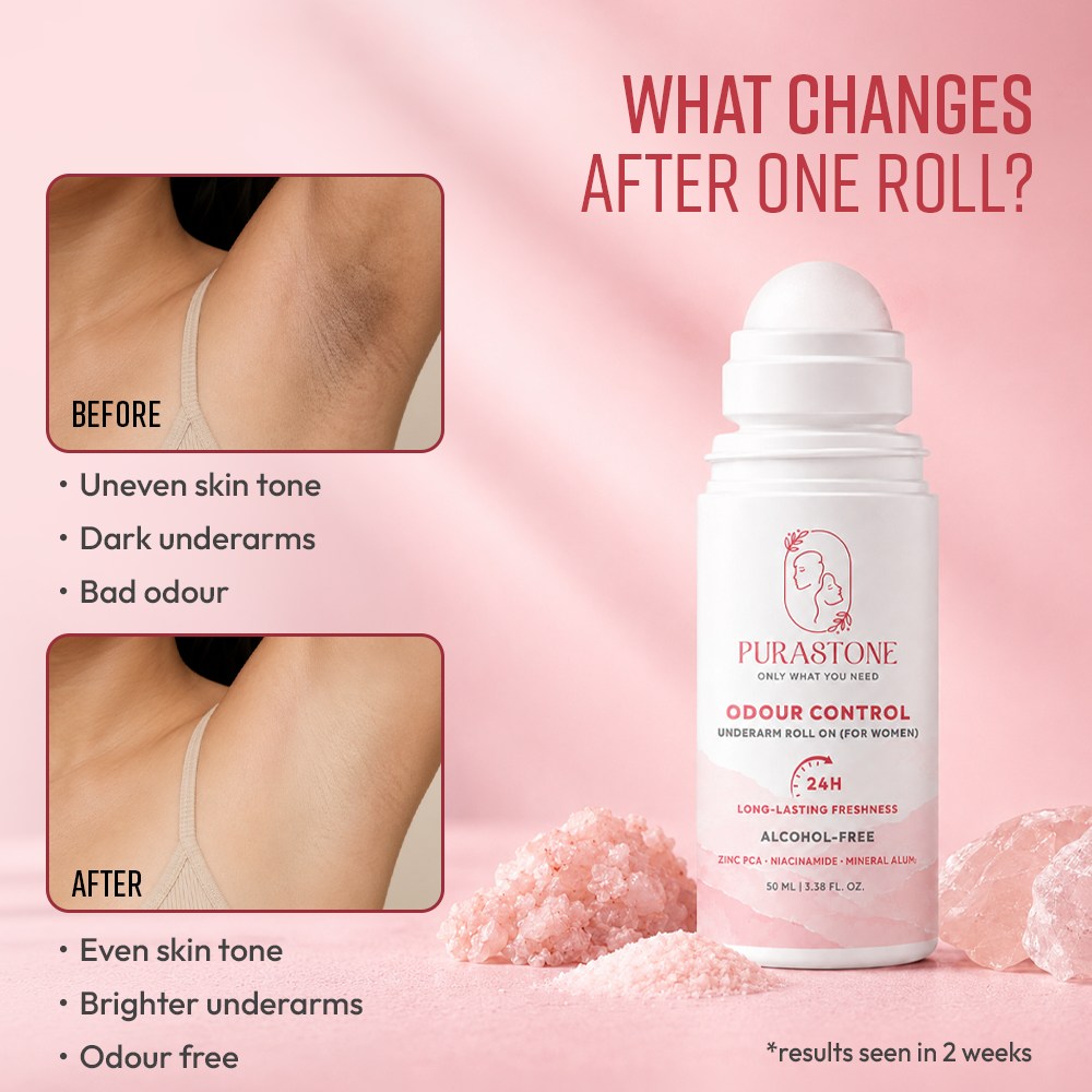 Odour Control (Women) | Niacinamide & Zinc PCA | Brightens Dark Underarms - 50ml
